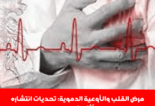 القلب والأوعية الدموية تحديات انتشاره وآثاره في مصر